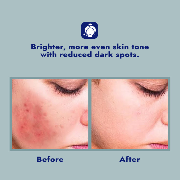 Dark Spot Serum for Sensitive Skin